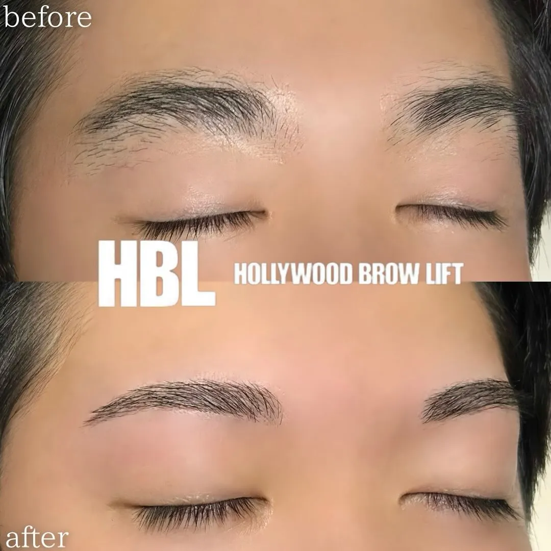 【滋賀 近江八幡 メンズハリウッドブロウリフト】